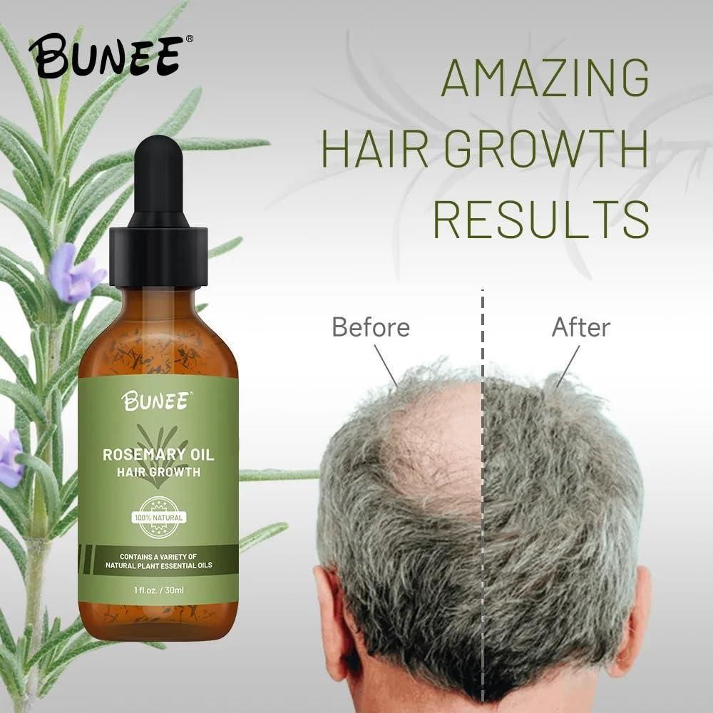 BUNEE Rosemary Hair Growth Serum Oil 30 ML(Pack of 2/3)